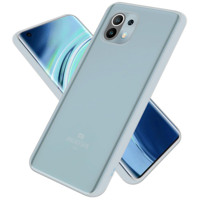 Transparent / Mi 11 5G